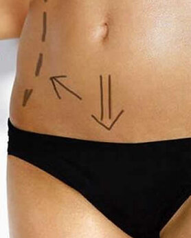 THE FASTEST WAY TO GET RID OF EXCESS WEIGHT