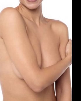 NEJEDNAKE GRUDI – KAKO I KADA SE RADI KOREKCIJA