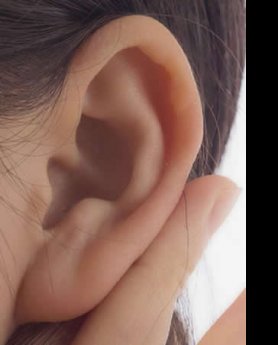 OPERACIJA UŠIJU – VAŠ NOVI IZGLED ZA JEDAN DAN!