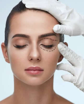 BLEFAROPLASTIKA - PODIZANJE I ZATEZANJE KAPAKA