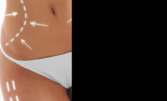 BRZO I LAKO DO ZATEGNUTOG I OBLIKOVANOG TELA - TOTAL BODY LIFTING