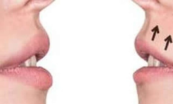 OPERACIJA NOSA - SVE ŠTO STE ŽELELI DA ZNATE