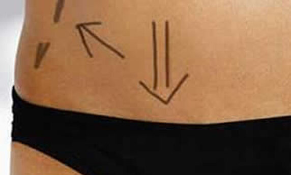 QUICK, EASY, AND SAFE WAY TO A BEAUTIFULLY SCULPTED BODY