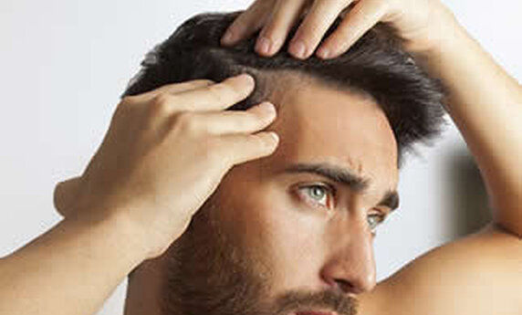 WHAT CAUSES HEREDITARY BALDNESS AND HOW TO TREAT IT?