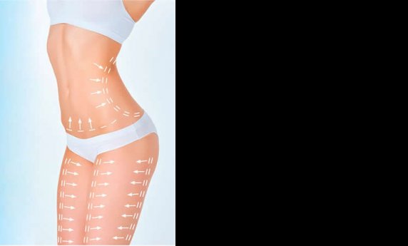 SPREMNI ZA LETO – OBLIKOVANJE TELA UZ BODYTITE APARAT