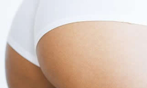 EVERYTHING YOU NEED TO KNOW ABOUT BUTTOCK AUGMENTATION